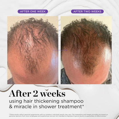 Tratamiento de Ducha Milagroso Dr. Groot